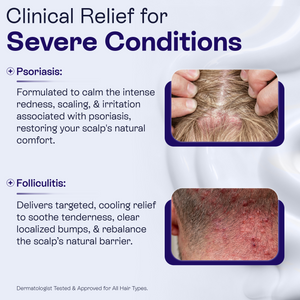 Keto Conditioner | Anti-Dandruff & Scalp Relief Care