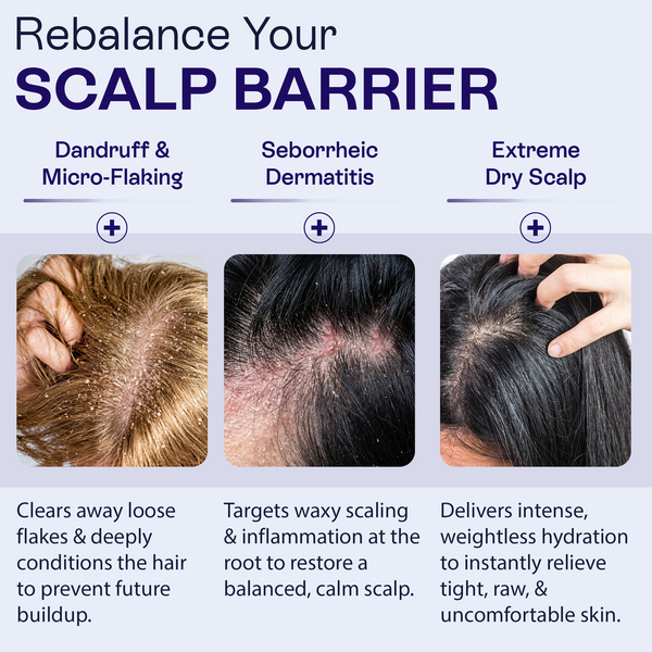 Keto Conditioner | Anti-Dandruff & Scalp Relief Care
