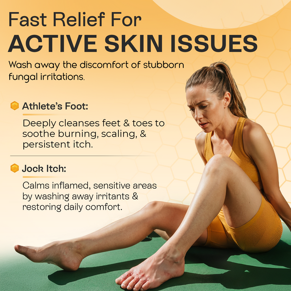 Psoriasis Body Wash | Itch, Redness & Flake Relief