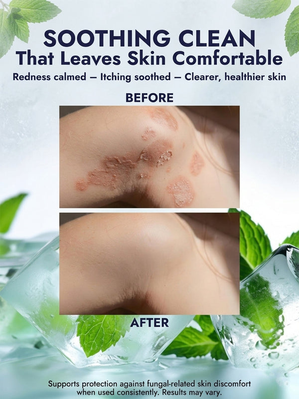 Mint Antifungal Soap + Scrubber