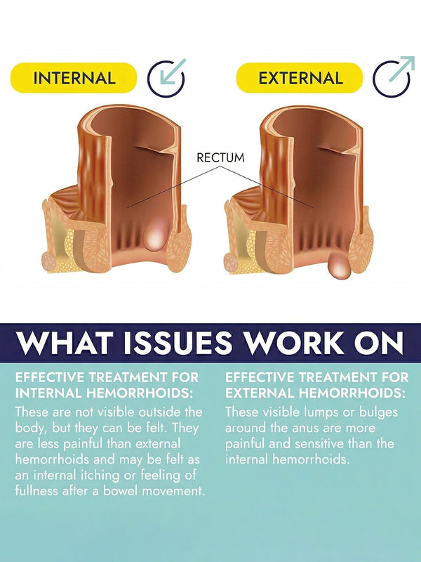 Hemorrhoid Suppositories - 24 Suppositories