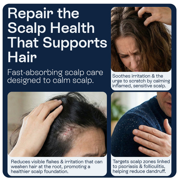 Psoriasis Scalp Spray for Flaking, Itching & Dryness