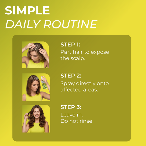 Folliculitis Scalp Spray
