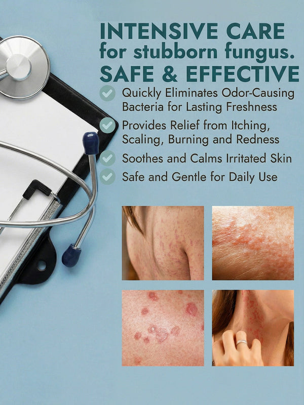 Antifungal Body Cream