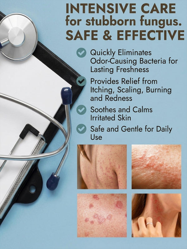 Antifungal Ringworm Cream