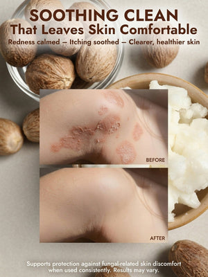 Shea Butter Antifungal Soap + Case