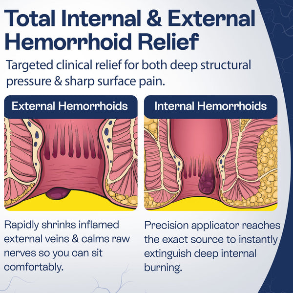 Hemorrhoid Cream | Fast Relief for Pain, Itching & Discomfort