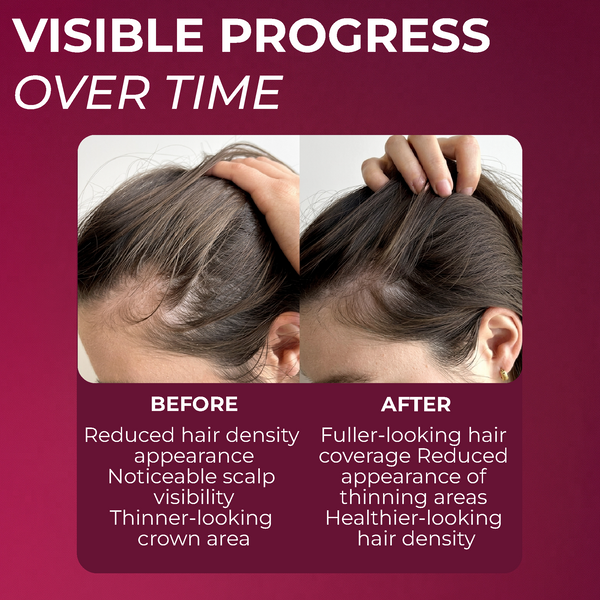 2% minoxidil for Women Spray