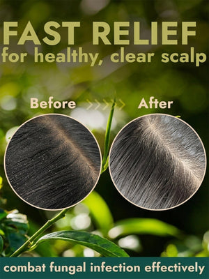 Tea Tree Scalp Scrub