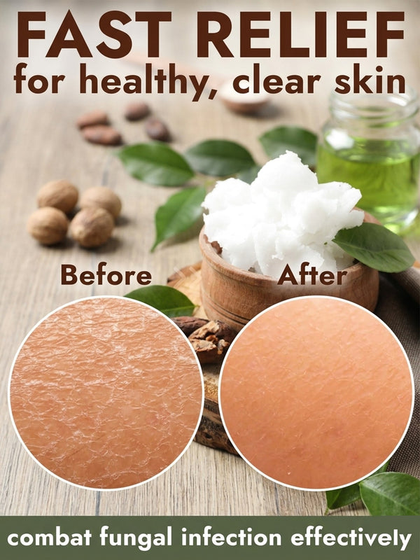 Shea Butter Antifungal Soap + Scrubber