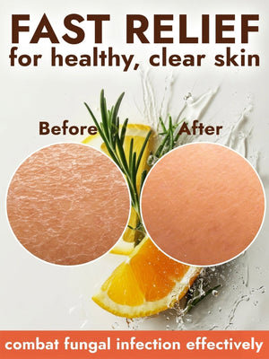 Citrus Antifungal Soap + Scrubber