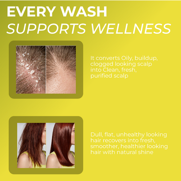 Folliculitis Shampoo Refill