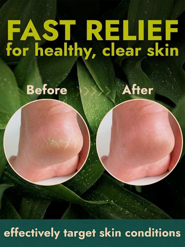 Foot Balm