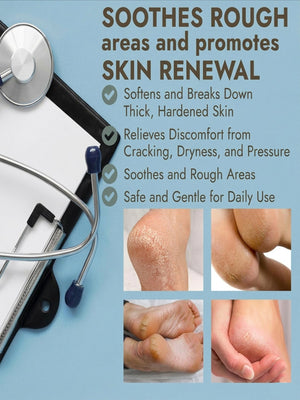 Callus Remover Gel
