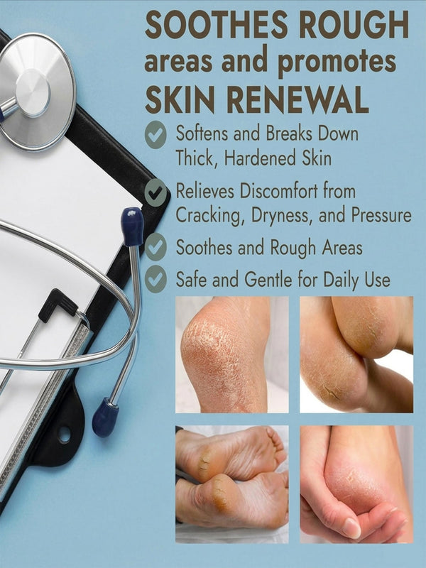 Callus Remover Gel