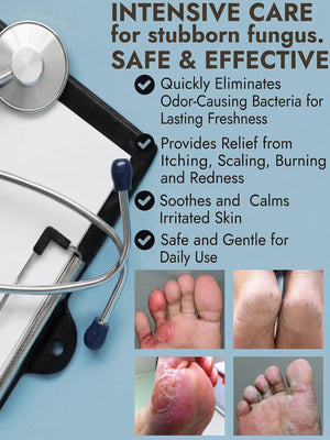 Antifungal feet cream