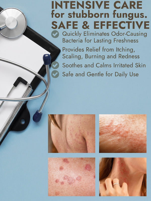 Tinea Spray