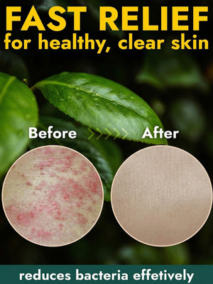 Antibacterial Soap + Case
