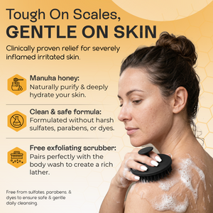 Psoriasis Body Wash | Itch, Redness & Flake Relief