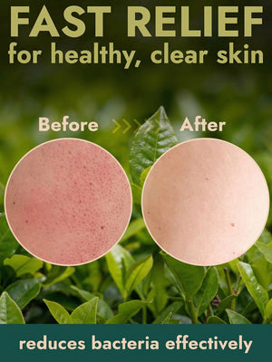 Antibacterial Body Scrub