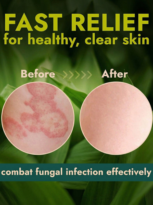 Antifungal Body Wipes - 2 pack