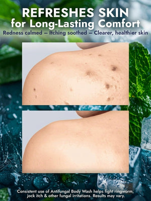Menthol Antifungal Body Wash + Scrubber