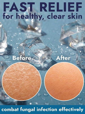Mint Antifungal Soap + Scrubber