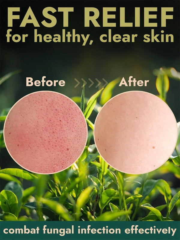 Antifungal Body Scrub