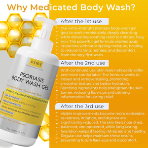 Psoriasis Body Gel