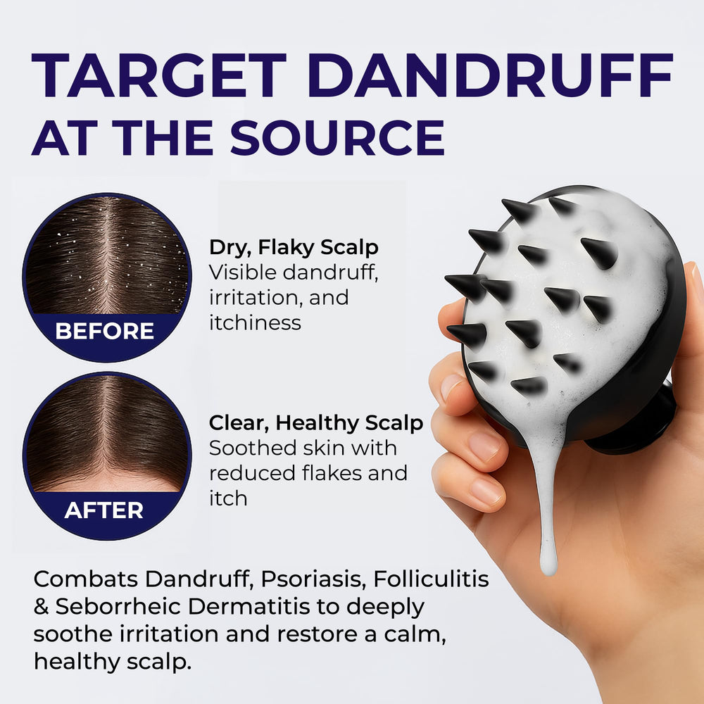 Pharmlitalia Scalp Psoriasis Shampoo, Flakes Shampoo Anti Dandruff, Itchy Scalp Treatment for Seborrheic Dermatitis & Folliculitis, Anti Fungal, Medicated Solution for Itchy, Flaky & Dry Hairs
