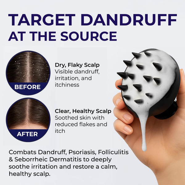 Pharmlitalia Scalp Psoriasis Shampoo, Flakes Shampoo Anti Dandruff, Itchy Scalp Treatment for Seborrheic Dermatitis & Folliculitis, Anti Fungal, Medicated Solution for Itchy, Flaky & Dry Hairs
