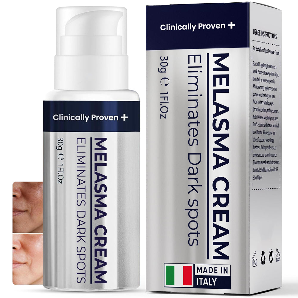 Melasma and Initmate Cream