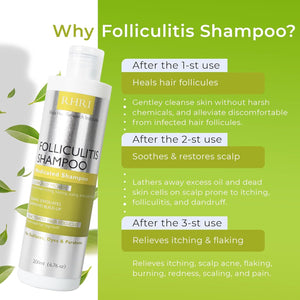 Folliculitis Shampoo | Antifungal Shampoo for Seborrheic Dermatitis, Scalp Psoriasis & Dandruff | Soothes Itchy, Dry Scalp | Cleanses, Exfoliates & Removes Build-Up | Reactivates Hair Follicles