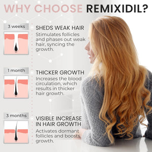 2% Minoxidil for Women Hair Regrowth Spray