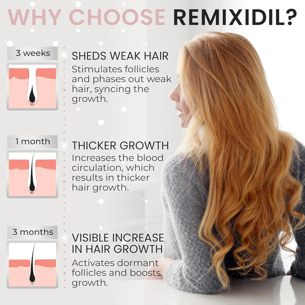 2% Minoxidil for Women Hair Regrowth Spray