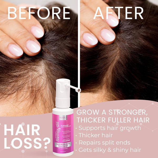 2% Minoxidil for Women Hair Regrowth Spray