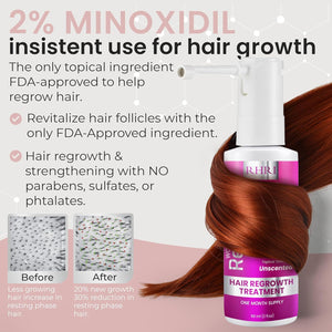 2% Minoxidil for Women Hair Regrowth Spray