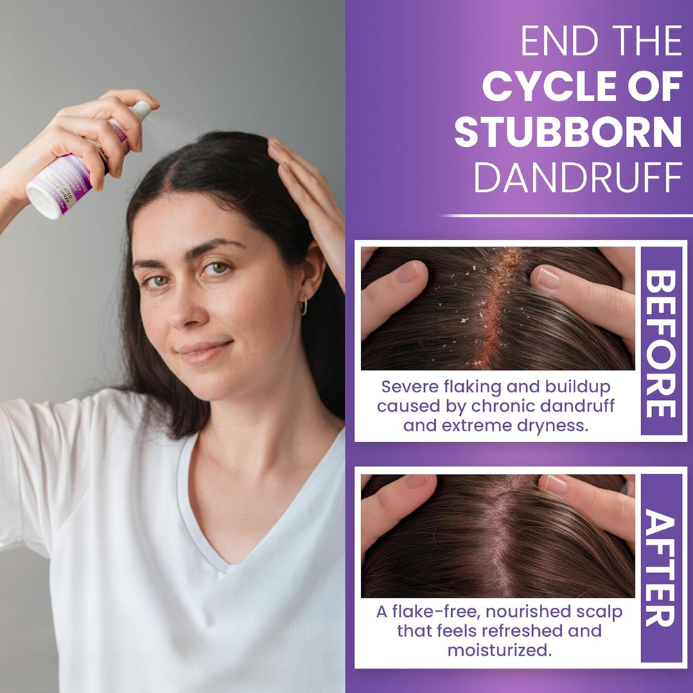 Neoketramin Anti Fungal Scalp Spray