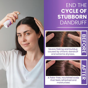 Neoketramin Anti Fungal Scalp Spray