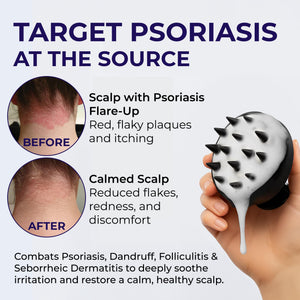 Pharmlitalia Scalp Psoriasis Shampoo