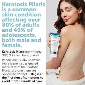 Keratosis Pilaris Treatment