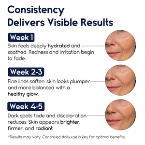 Anti Wrinkle Matrixyl 3000 Hyaluronic Acid Serum
