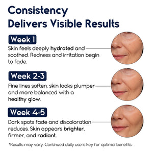 Matrixyl 3000 Hyaluronic Acid Serum for Face