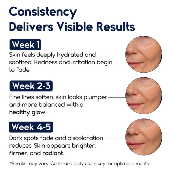 Matrixyl 3000 Hyaluronic Acid Serum for Face