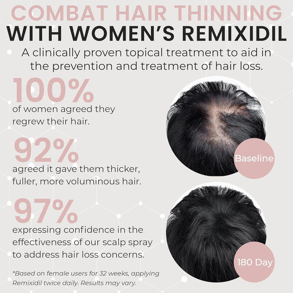 2% Minoxidil for Women Hair Regrowth Spray