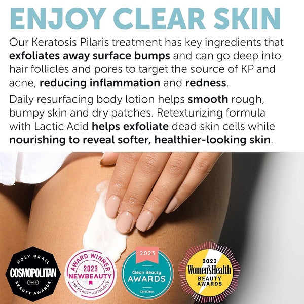 Keratosis Pilaris Treatment