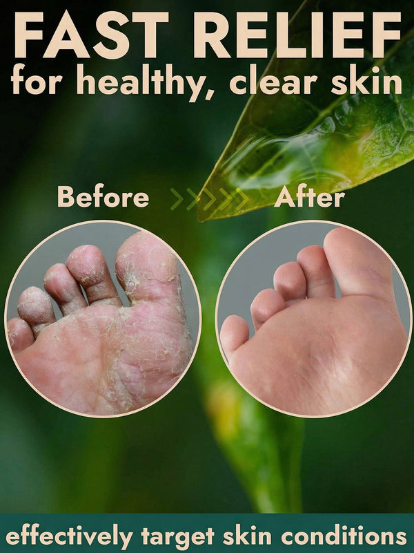 Antifungal Foot Spray