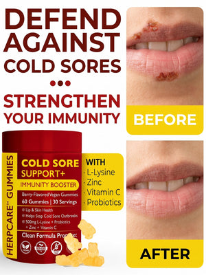 Cold Sore Gummies