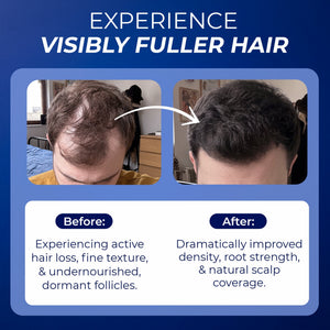 Hair Growth Vitamins Men