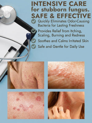 Antifungal Ringworm Spray